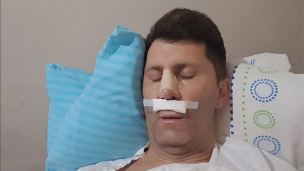 Ahmet Çevik son dakika ameliyat oldu | Ahmet Çevik Kimdir? Kaç Yaşında?